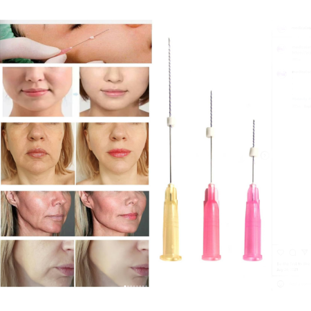 Curs Acupunctura cu ace pentru insertie cu fir chirurgical resorbabil (cod Y02L)