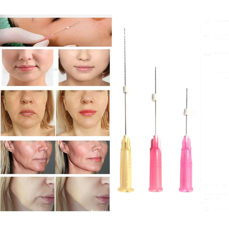 Curs Acupunctura cu ace pentru insertie cu fir chirurgical resorbabil (cod Y02L)